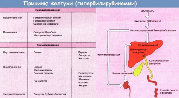 Причины желтух