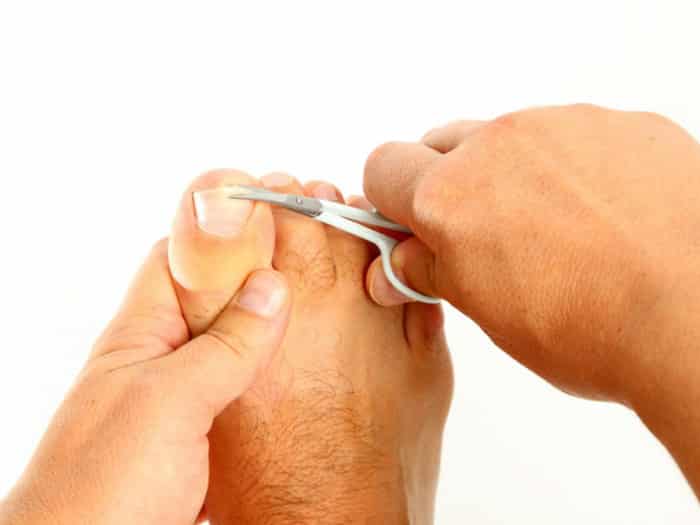 как правильно стричь ногти на ногах