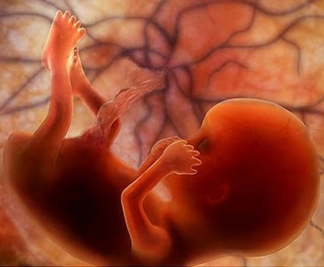 Фото плода на 13 неделе беременности (возраст плода 11 недель)