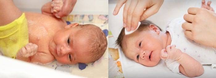 Потница у детей: симптомы и лечение, фото высыпаний на лице и попе