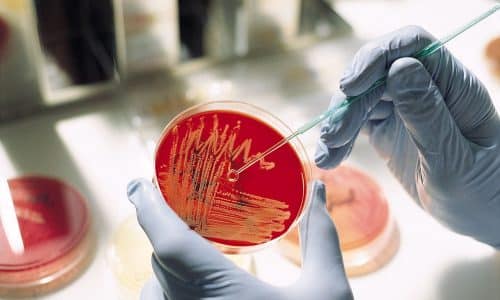Бакпосев мочи используется для идентификации возбудителя инфекции и определения его чувствительности к антибактериальным веществам
