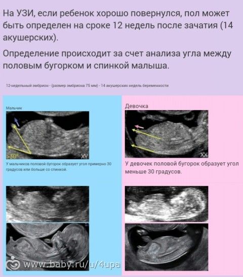 На какой недели пол ребенка можно