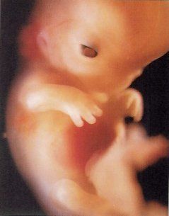 очень интересная статья с картинками.3-й месяц беременности