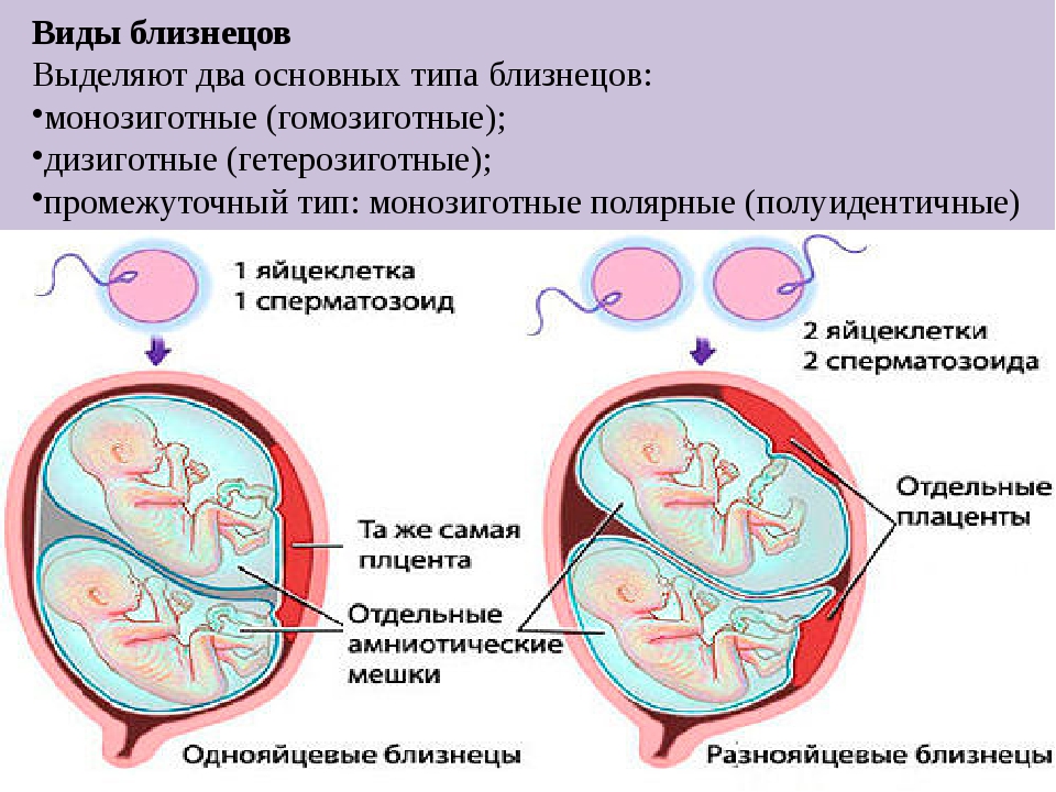 Однояйцевые близнецы пол. Многоплодная беременность разнояйцевые Близнецы. Монохориальная биамниотическая двойня. Механизм образования однояйцевых близнецов. Виды близнецов схема.