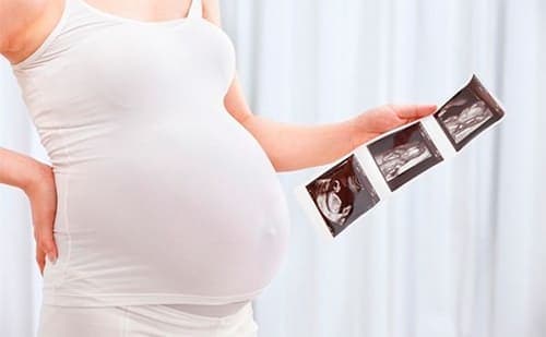 сколько раз при беременности можно делать узи