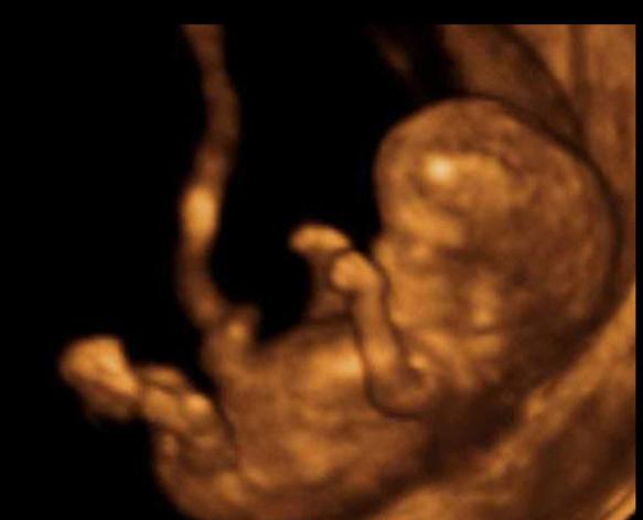 12 недель беременности фото 3d и узд на мальчика