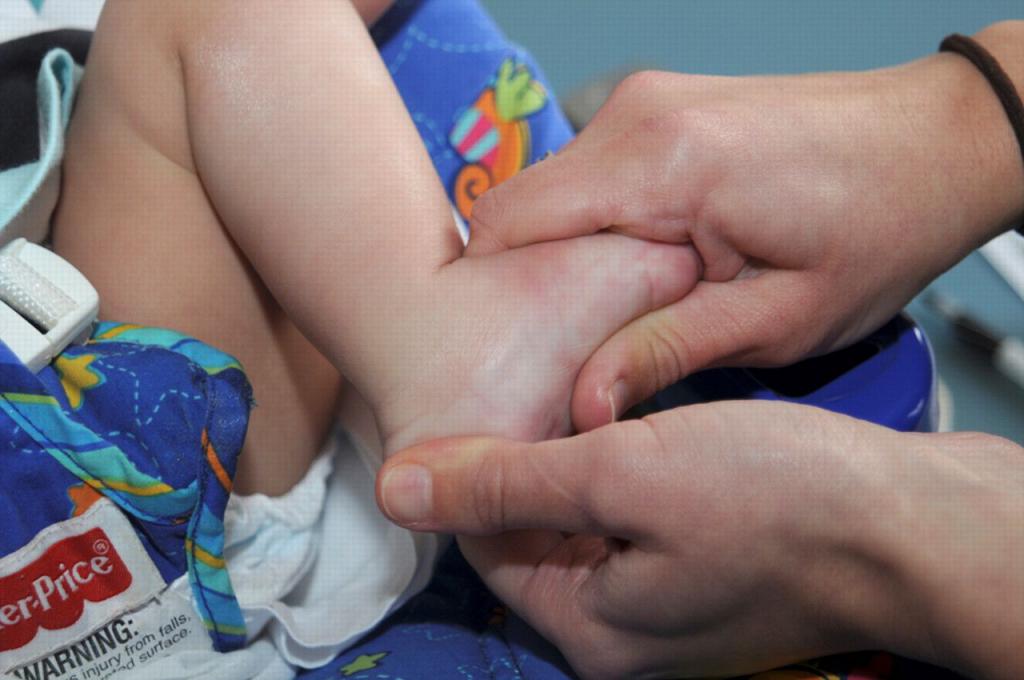икс образные ноги у детей лечение