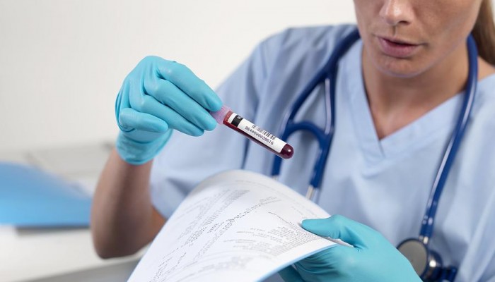 1-doctor-checking-a-blood-sample-tek-image