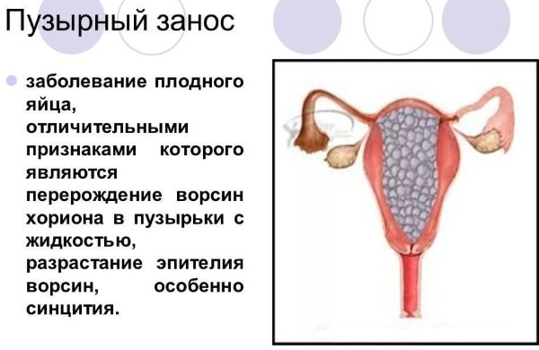 Выделения при беременности на ранних сроках. Нормы, какие бывают, что значат