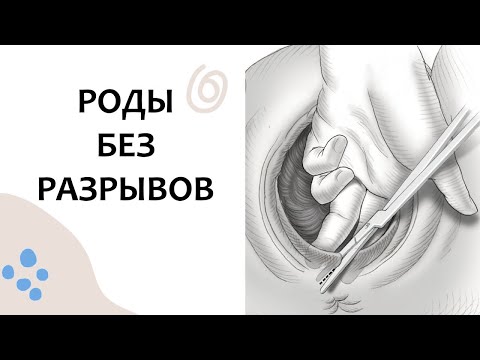 Как НЕ ПОРВАТЬСЯ в РОДАХ. Выпуск 92