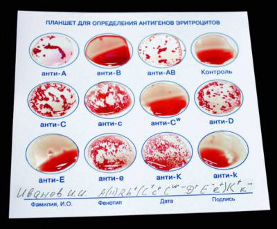 Определение групп крови