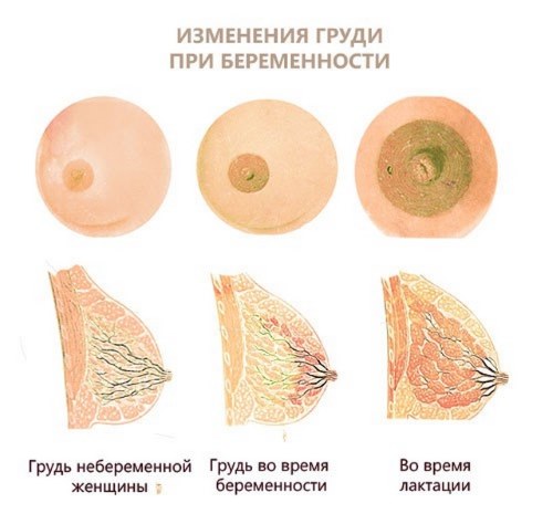 Боли в груди при беременности – как, сколько, на каком сроке