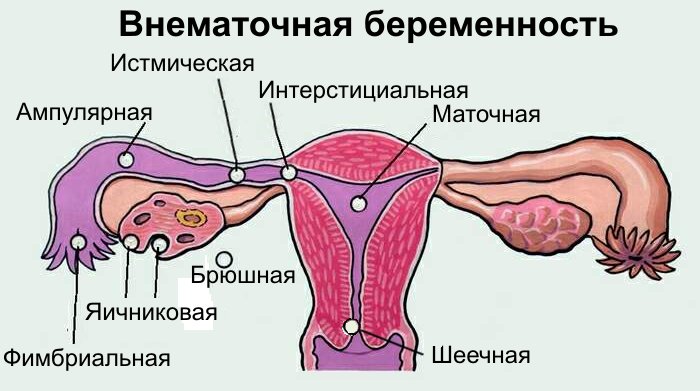 Боли в груди при беременности – как, сколько, на каком сроке