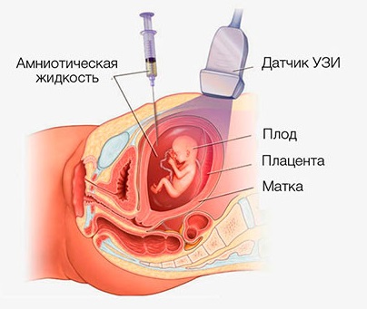 Таблица зачатия пола ребенка по возрасту матери, отца, группе крови, по Ванге, китайскому, японскому календарю. Как запланировать и рассчитать