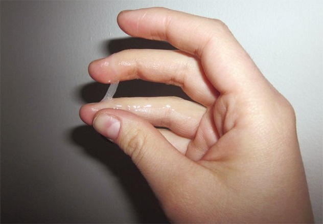 водянистые выделения при беременности на руке