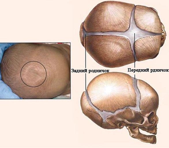 Различают боковые роднички, малый и большой