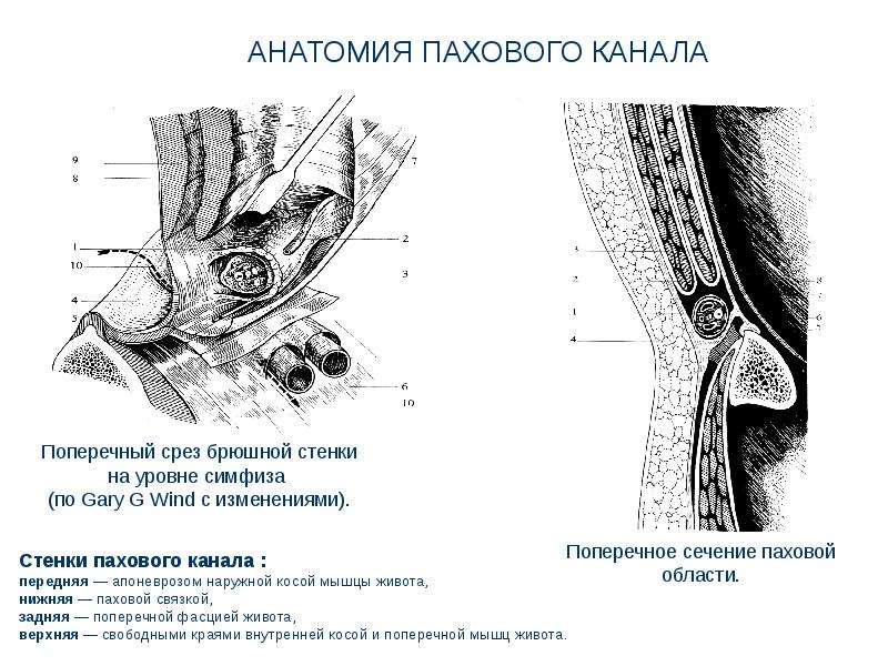 Стенки пахового канала. Стенки пахового канала топографическая анатомия. Поперечное сечение пахового канала. Паховый канал анатомия стенки. Паховая грыжа анатомия схема.