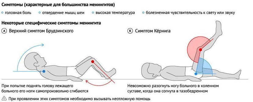 Симптомы менингита