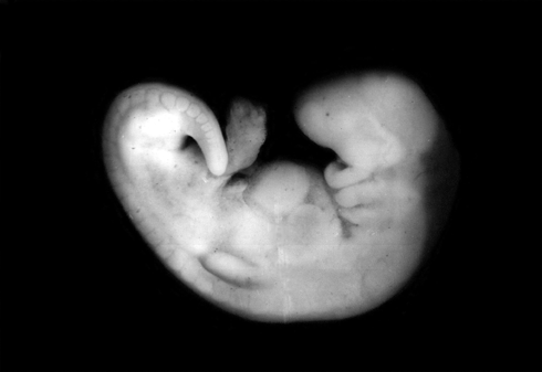 фото эмбриона