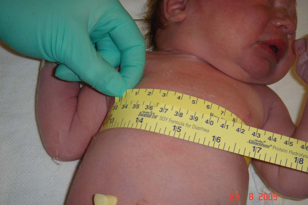 Алгоритм окружности головы. Измерение окружности грудной клетки у детей. Антропометрия измерение окружности грудной клетки. Измерение окружности грудной клетки грудного ребенка. Измерение окружности груди грудного ребенка.