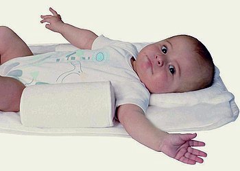 Симптомы кривошеи у новорожденных