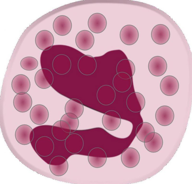 Эозинофилы – это лейкоциты, которые способны определить наличие инфекции, паразитов, аллергической реакции в крови, а также показать воспалительный процесс или наличие опухоли