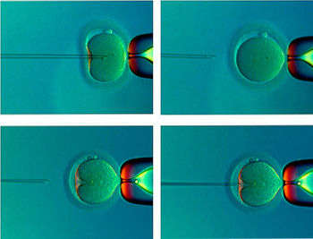 Как происходит ЭКО - микроинъекция