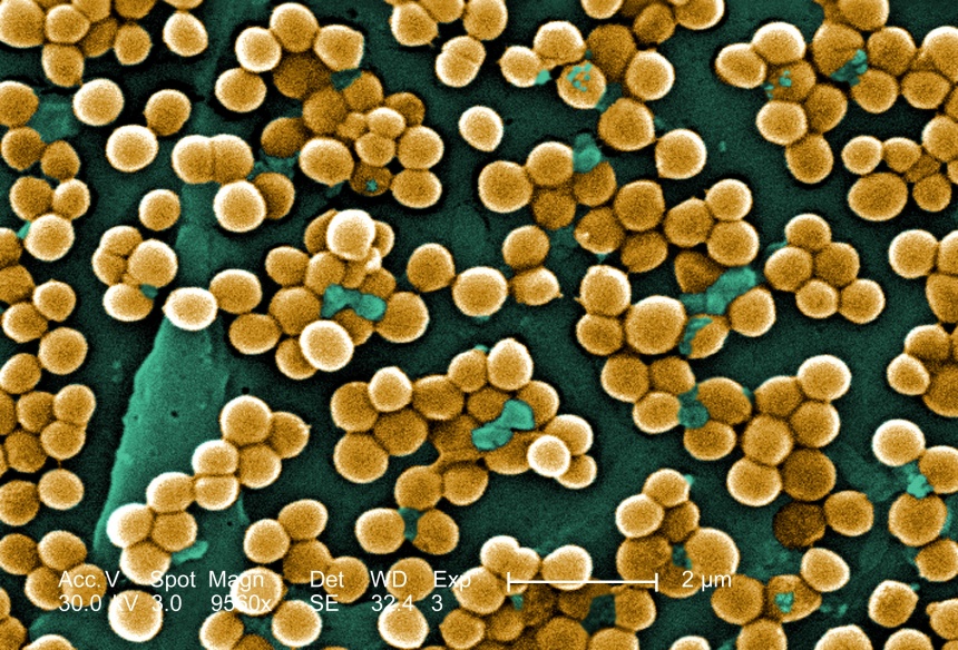 Вы не одиноки, ведь в вас точно есть бактерии, микроскопические грибы и вирусы 