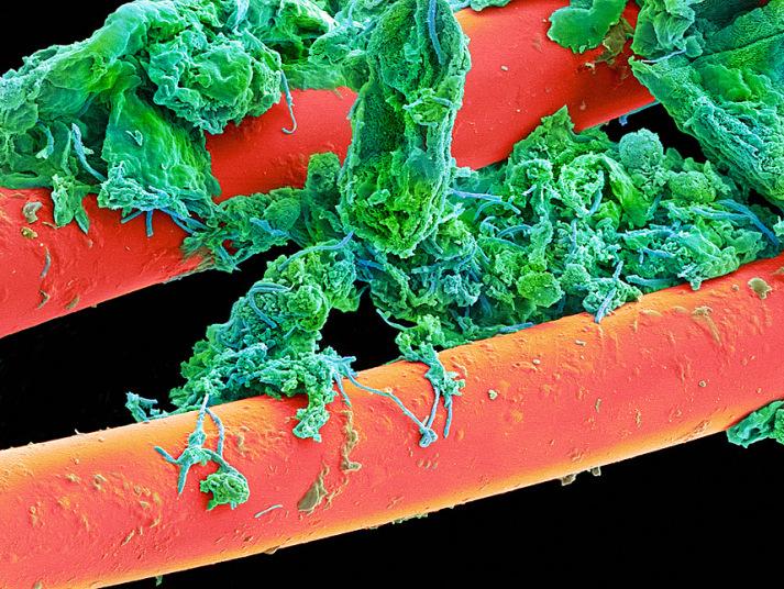 Фотографии зубов под микроскопом или как в действительности выглядит зубной налет