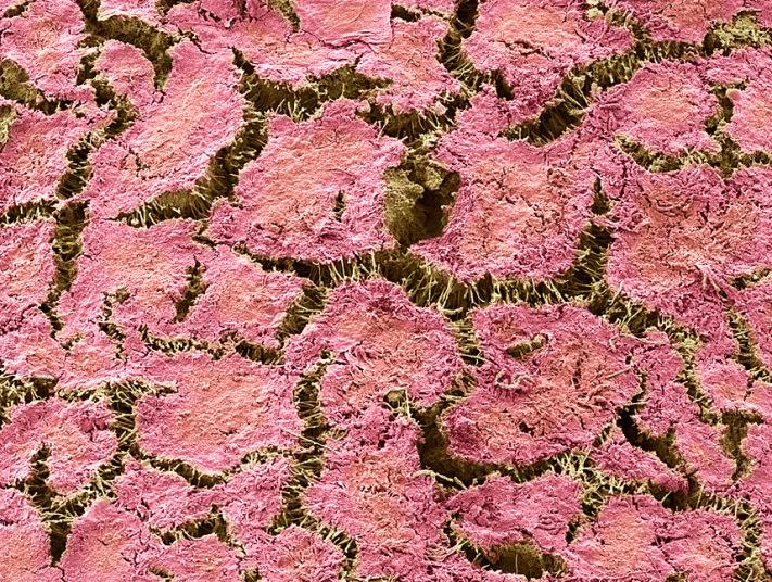 Фотографии зубов под микроскопом или как в действительности выглядит зубной налет