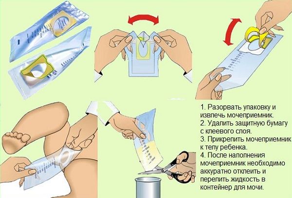 Пользование мочеприемником