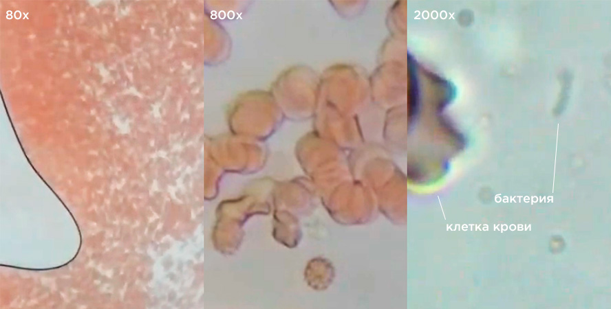 Кровь под микроскопом