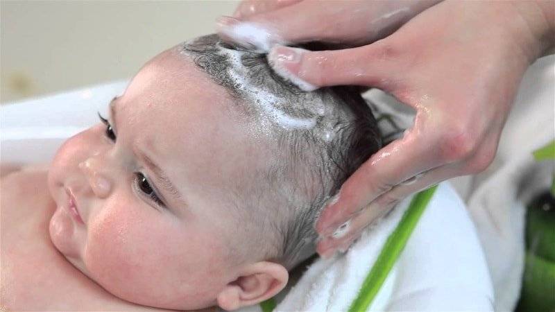 Как убрать корочки на голове младенца