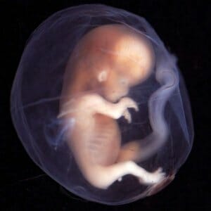 Эмбрион человека