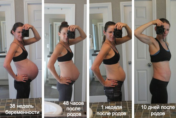 Изменение тела до и после родов