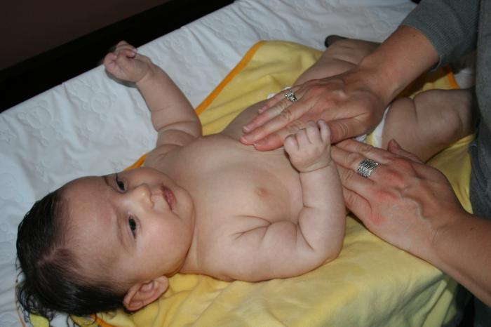 массаж пупочной грыжи у новорожденных