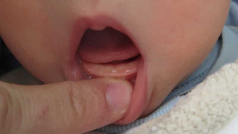 первые зубы у ребенка