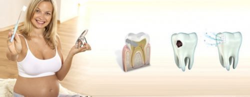 Лечение зубов при беременности необходимо